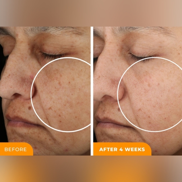 🧡BeautyStat Vit C Serum🧡 - Picture 7 of 8